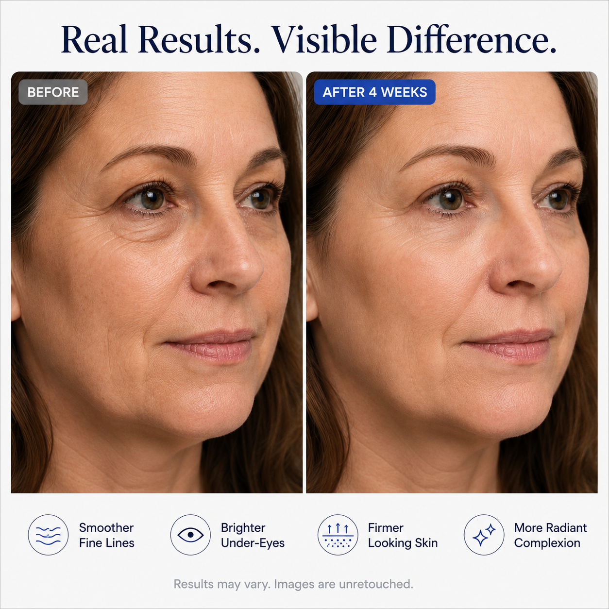 Tevia Micro-Infusion Targeted Patches