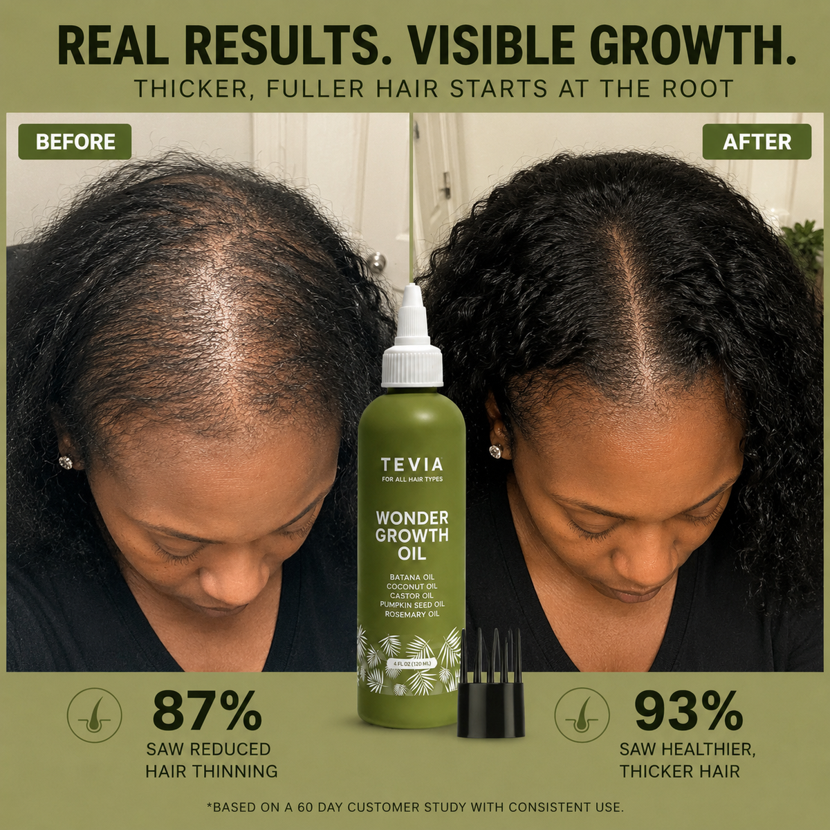 Tevia Wonder Growth Oil