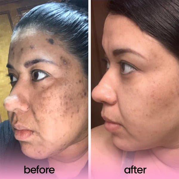 SculptivaBeauty Brightening Pads