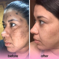 SculptivaBeauty Brightening Pads