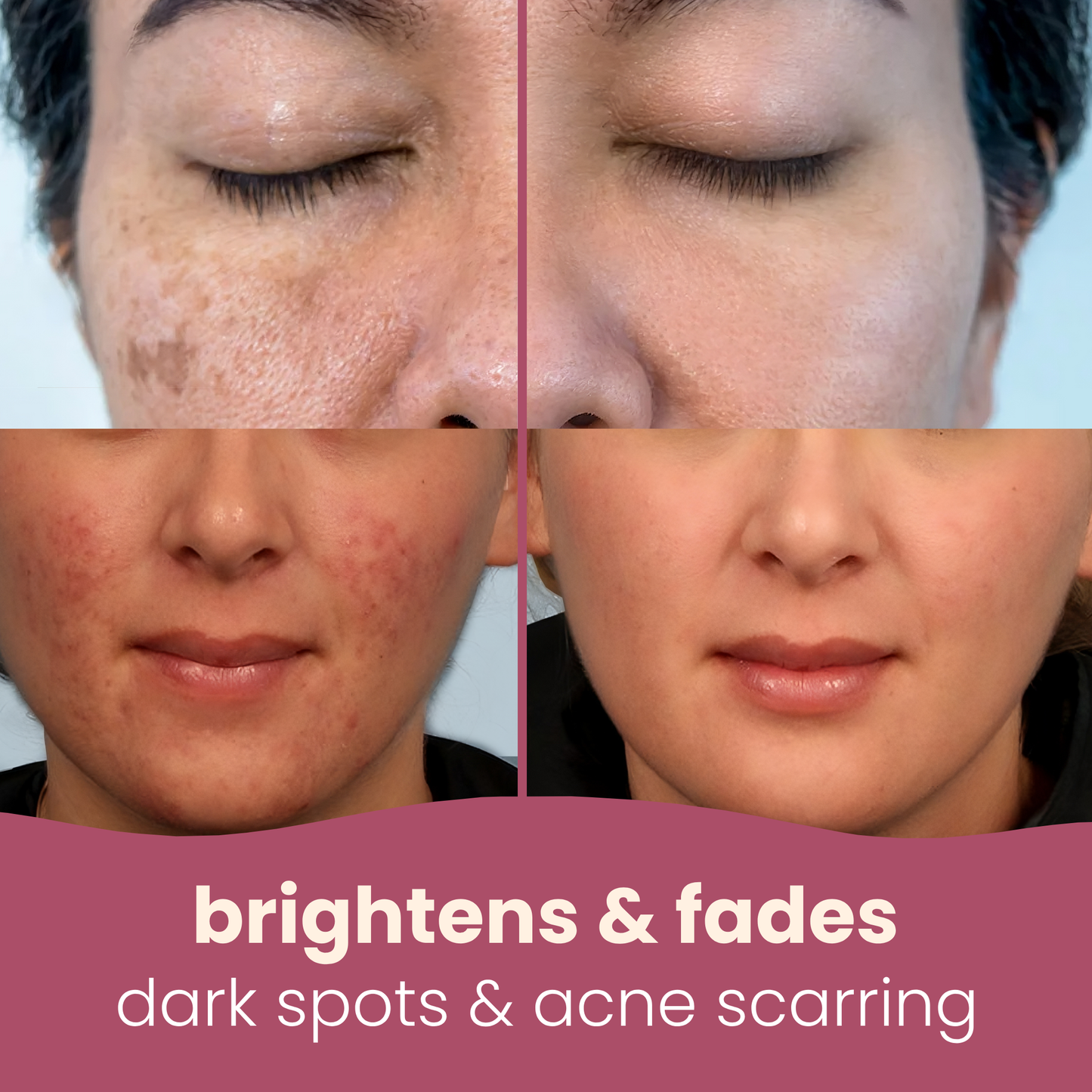 SculptivaBeauty Brightening Pads